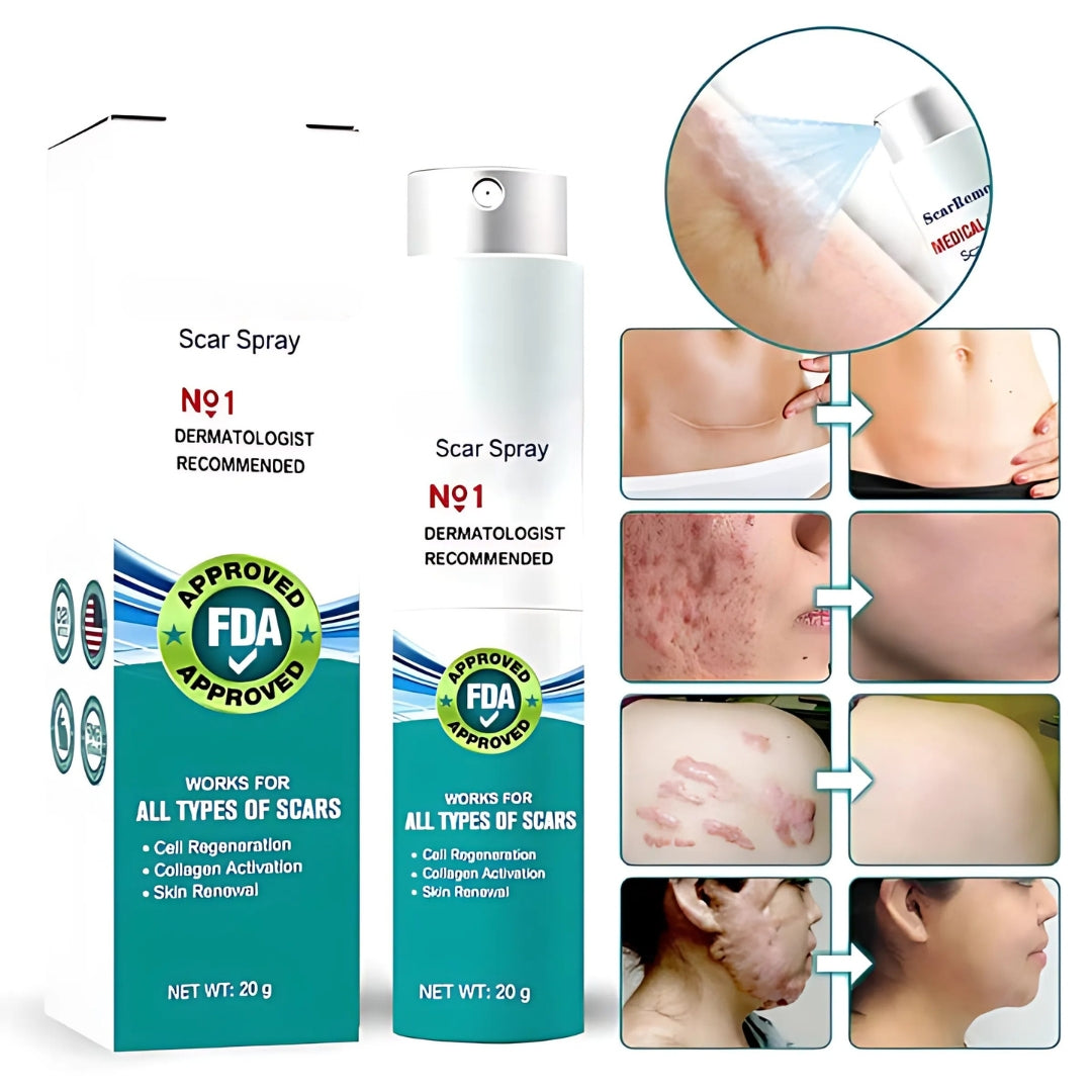 Scar Spray | Lässt Narben schnell und effektiv verblassen