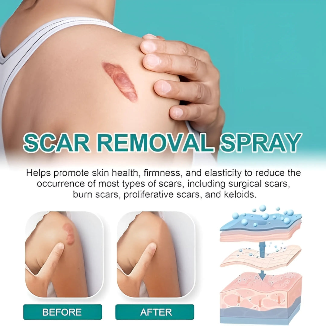 Scar Spray | Lässt Narben schnell und effektiv verblassen