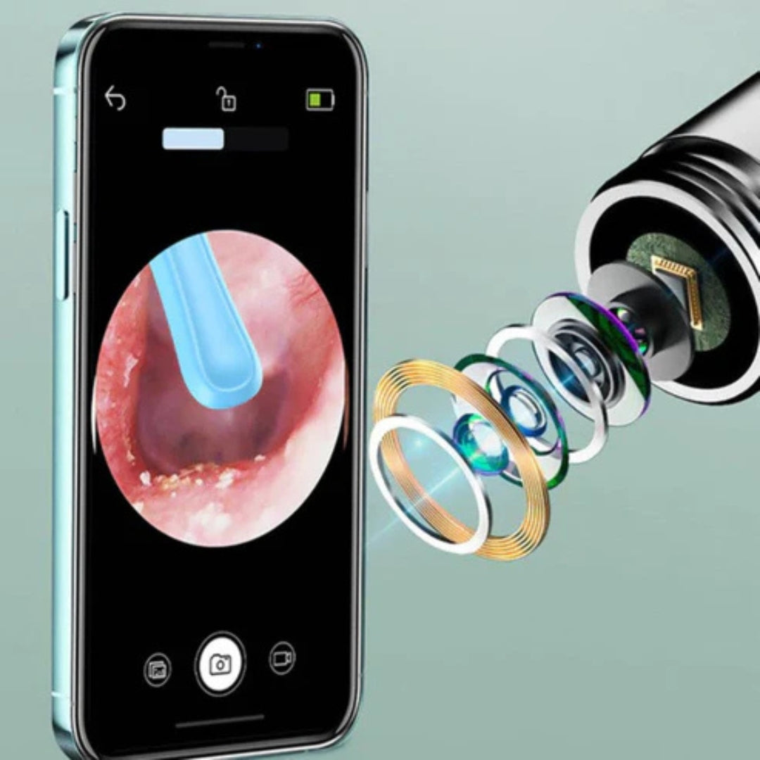 ClearEar | Visueller Ohrreiniger mit HD-Kamera