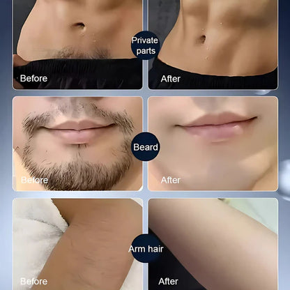 SmartShaver | Kabelloses Elektrisches Rasiergerät für Männer