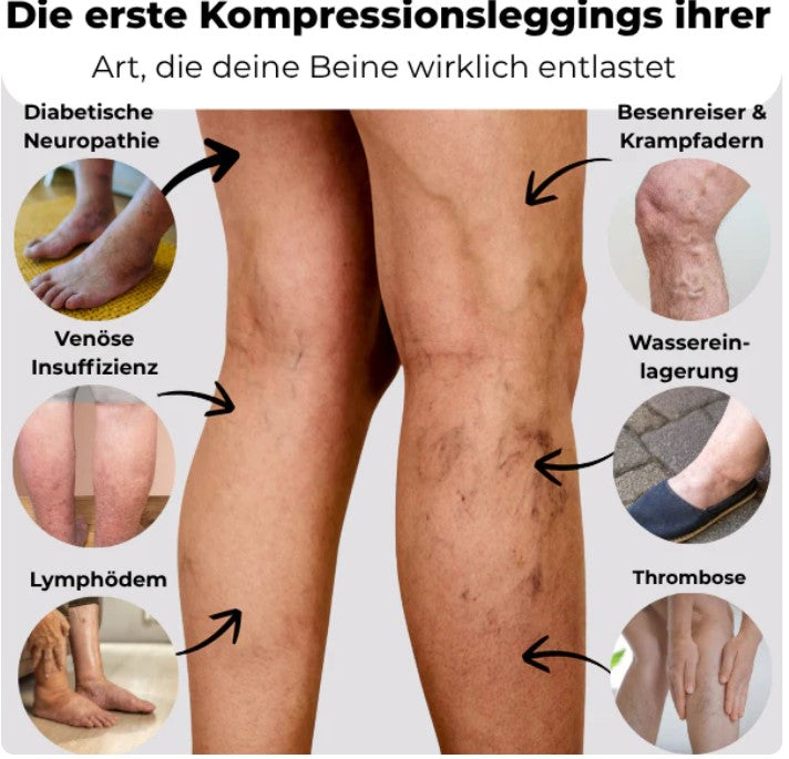 FRAMI ActiveShape | 3D-Kompression für Mehr Power und Straffere Konturen