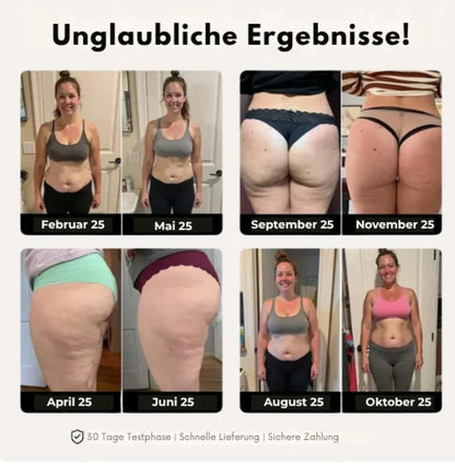 FRAMI ActiveShape | 3D-Kompression für Mehr Power und Straffere Konturen