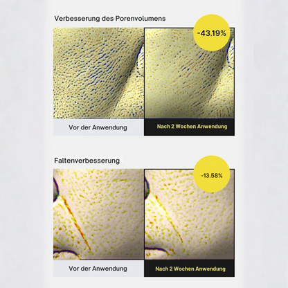 Celimax Retinal| Intensiver Anti-Aging Booster für straffe Haut