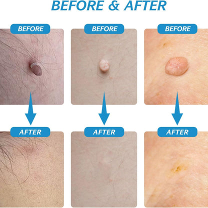 SkinClear | Komplett-Set für Sanfte und Strahlende Haut